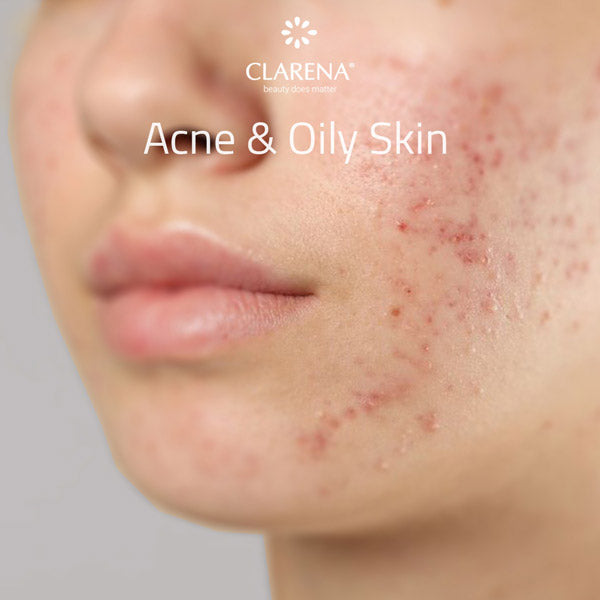 Clarena acne & oily skin collection — oil control, cleansing and blemish-preventing formulas