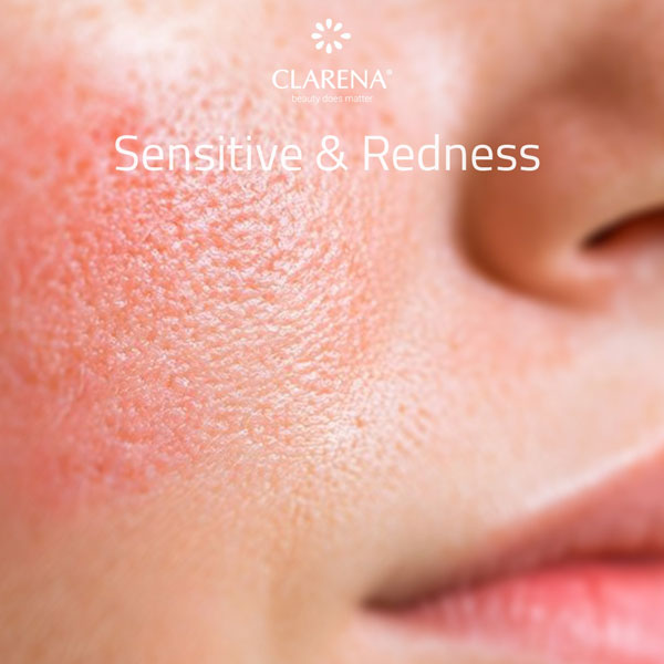 Clarena sensitive & redness relief collection — calming skincare for reactive skin